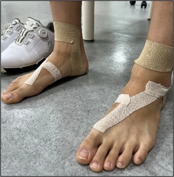 オーダーインソール